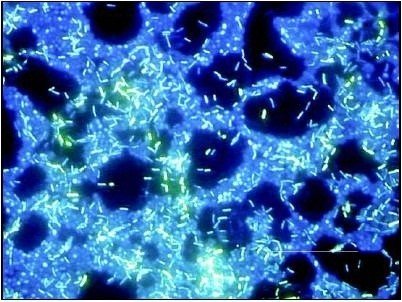 BUM500FLD LCD Upright Fluorescence Microscope