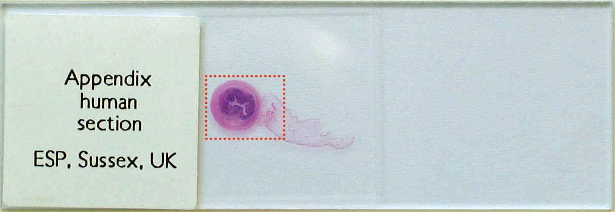 turboscan appendix slide3
