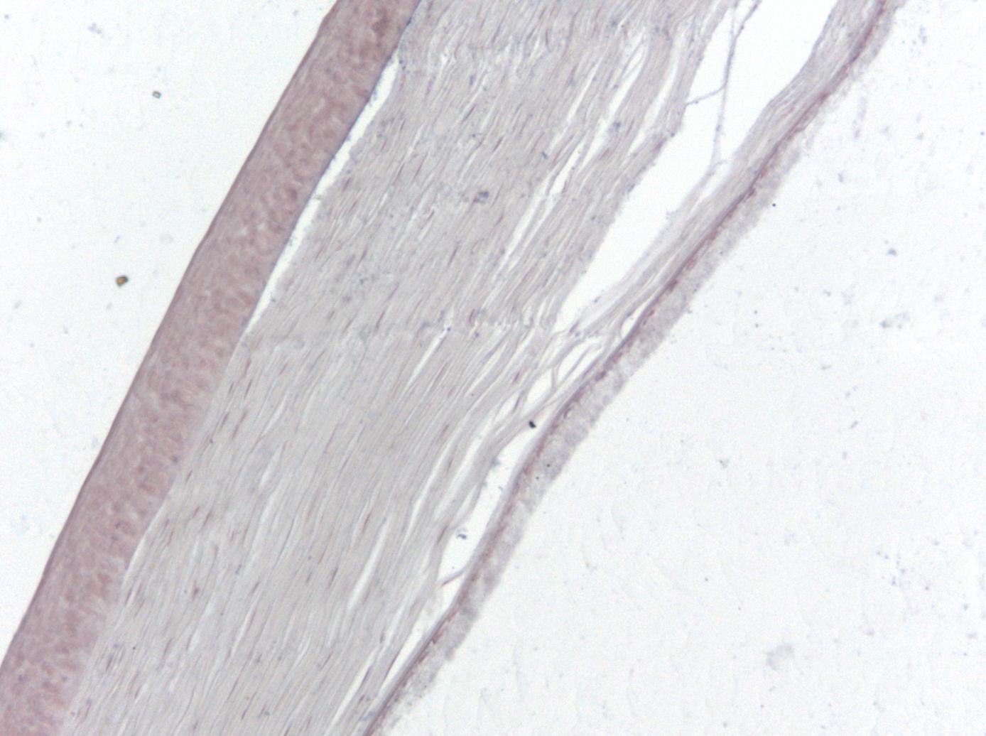 turboscan eye detail