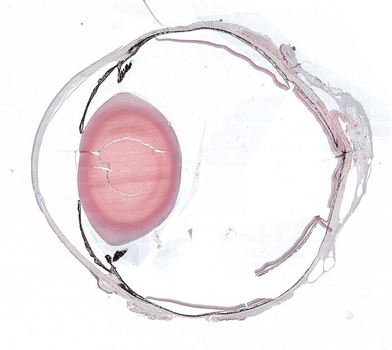 turboscan eye medium