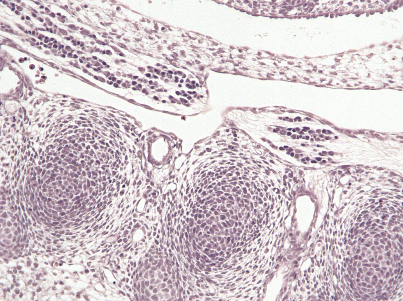 turboscan foetus detail
