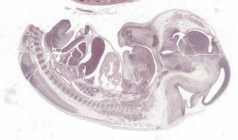 turboscan foetus medium