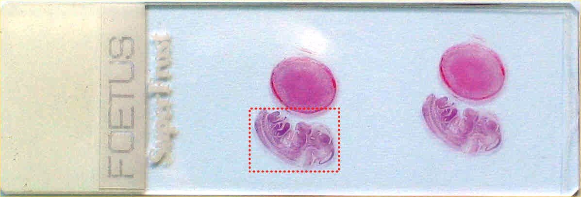 turboscan foetus slide