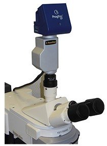 3D Microscope Add-On: ZeeScan