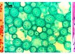 BIM600FL Inverted Epi-Fluorescnce Biological Microscope