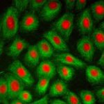 BIM500FL Inverted Epi-Fluorescnce Biological Microscope