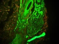 Meiji Techno (Japan) TC-5600 Series Inverted Epi-Fluor Biological Microscope