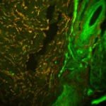 Meiji Techno (Japan) TC-5600 Series Inverted Epi-Fluor Biological Microscope