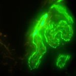 Meiji Techno (Japan) TC-5600 Series Inverted Epi-Fluor Biological Microscope