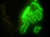 Meiji Techno (Japan) TC-5600 Series Inverted Epi-Fluor Biological Microscope