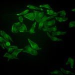 BIM800FLW Inverted Epi-Fluorescence Biological Microscope