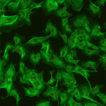 Meiji Techno MT6200 / MT-6300 Upright Epi-Fluorescence Biological Microscope-10499