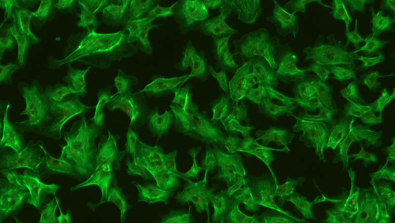 Meiji Techno MT6200 / MT-6300 Upright Epi-Fluorescence Biological Microscope-10499