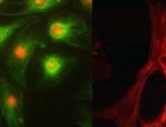 Epi-fluorescent Illumination Alignment Slide