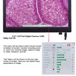 BDC-5012 HD Display Camera: 11.6" HD Monitor with 5MP Camera