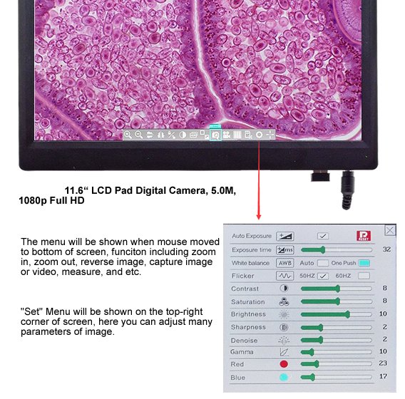 BDC-5012 HD Display Camera: 11.6" HD Monitor with 5MP Camera