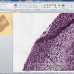 Pathology and Immunohistochemistry Analysis with Image-Pro Premier Software