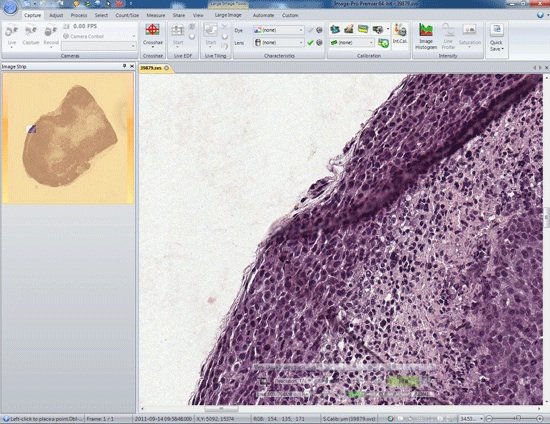 Pathology and Immunohistochemistry Analysis with Image-Pro Premier Software