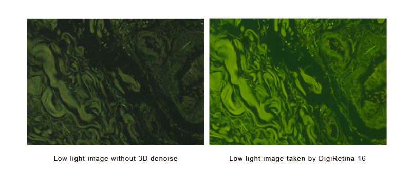 BRC-1600 16MP USB 3.0 Retina HD Colorful CMOS Microscope Camera