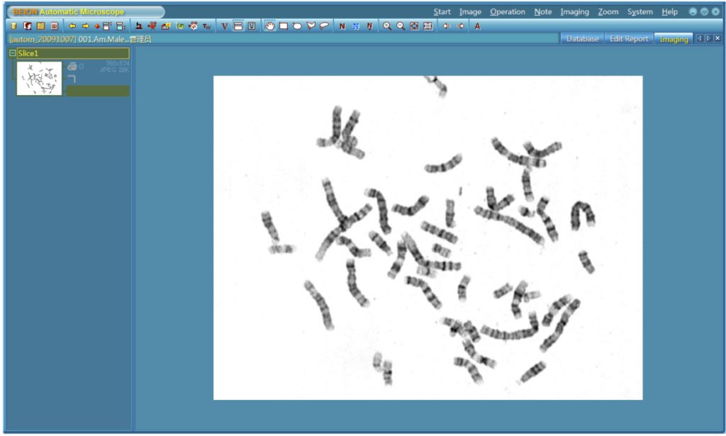 BUM400A Fully Motorized Auto-Focus Biological Microscope-9850