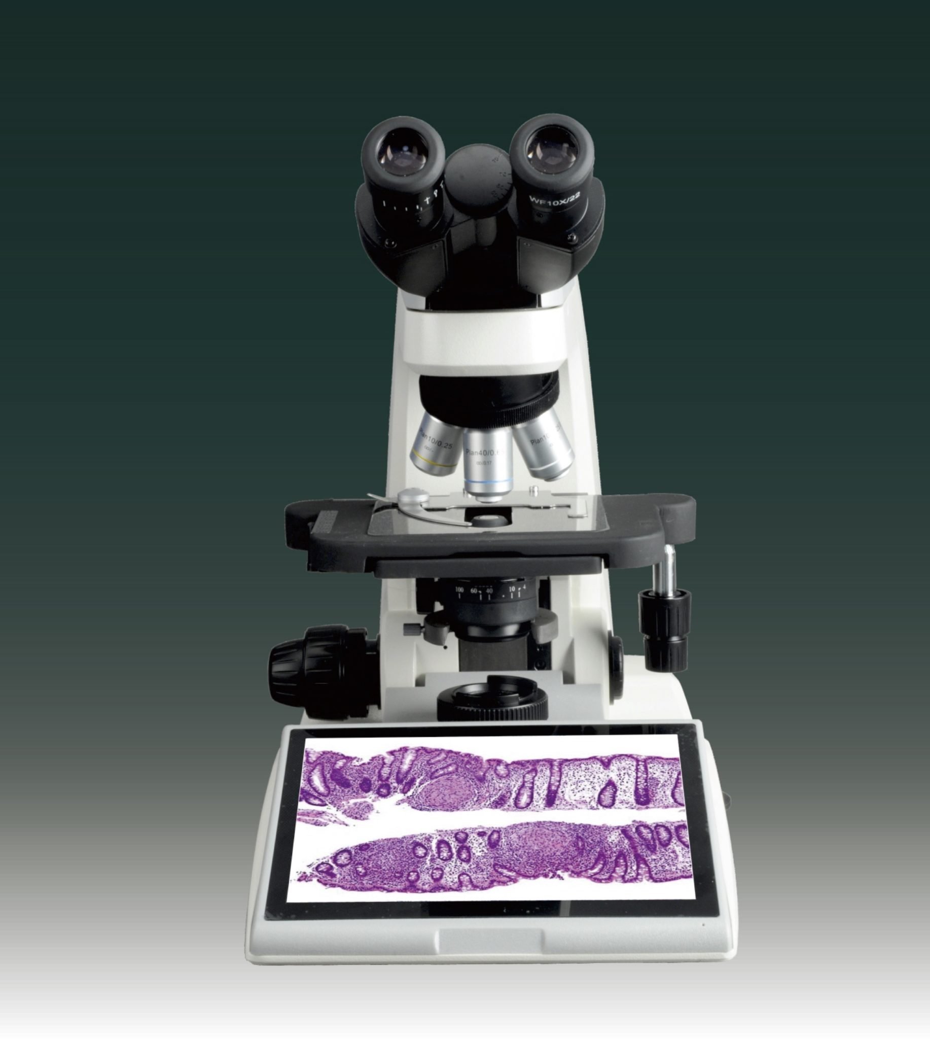 BUM340L-16MP Upright Biological/Clinical Microscope with 16MP Camera & 9.7" Touch Screen-10284