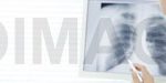 Medi 5000 Digitizer for Mammography Grade Certified by CE MDD & TFDA -10397