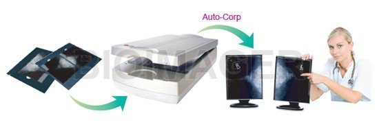 Medi 5000 Digitizer for Mammography Grade Certified by CE MDD & TFDA -10399