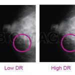 Medi 5000 Digitizer for Mammography Grade Certified by CE MDD & TFDA -10400