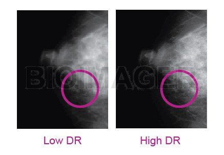 Medi 5000 Digitizer for Mammography Grade Certified by CE MDD & TFDA -10400