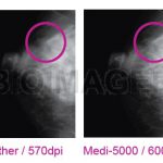 Medi 5000 Digitizer for Mammography Grade Certified by CE MDD & TFDA -10401
