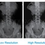 Medi 6000 Plus X-Ray Digitizer, FDA Certified-10393