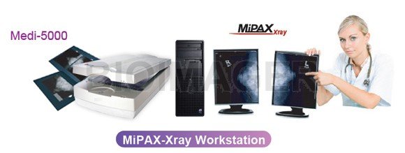 Medi 5000 Digitizer for Mammography Grade Certified by CE MDD & TFDA -10402