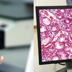 Whole Slide Imaging Software of MicroVisioneer -0