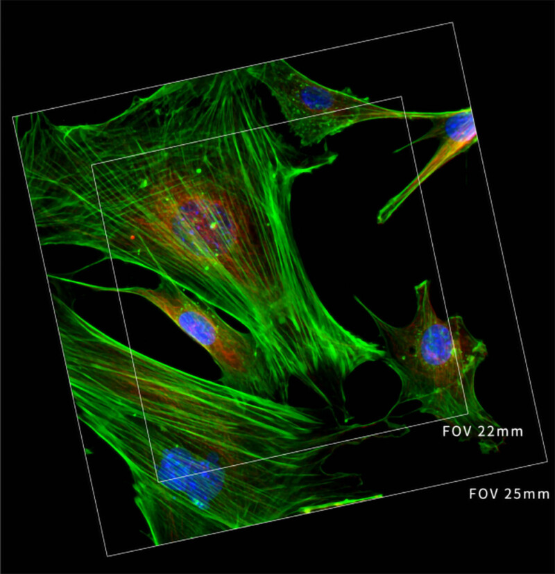 BIM1000A Inverted Advanced Microscope for Research - Image 25