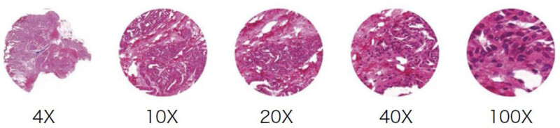 BRC-1060 LCD Digital Biological Microscope with 6.0 MP High Sensitive Camera & Full HD Retina LCD Screen - Image 17