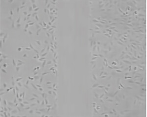 IncuScope BX-300A