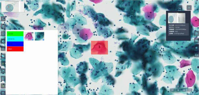 BioScan A200 Digital Pathology Section Scanner