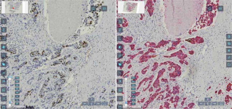BioScan A200 Digital Pathology Section Scanner