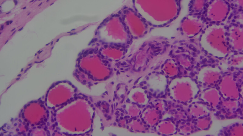 BIC-AF4-Pear-Simple-Cuboidal-Epithelium-Sec